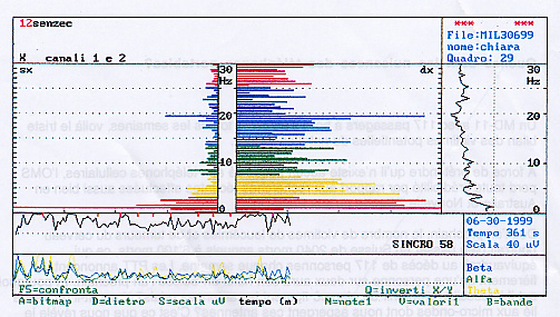 image ondes