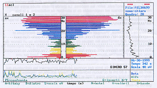 image ondes